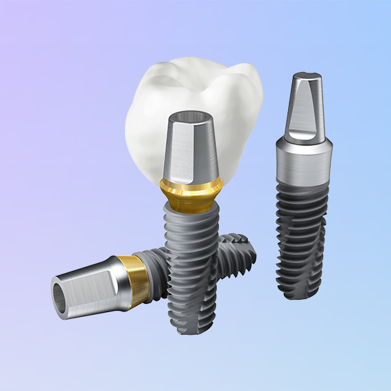 Имплантация зубов