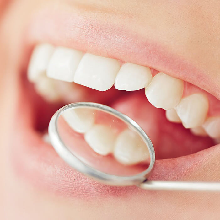 Лечение зубов