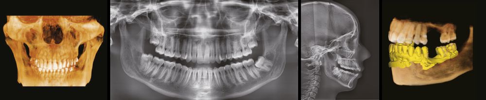 Новейшая цифровая рентгеновская система визуализации 4-в-1