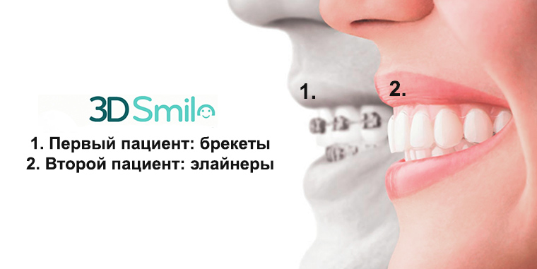 elainery-3d-smile-1.jpeg elainery-3d-smile-1.jpeg