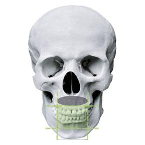 Эндо и одиночный имплантат 4x4/5x5