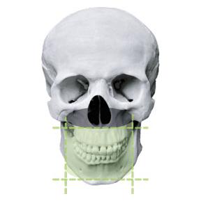 Часть зубного ряда 8x5/8x8